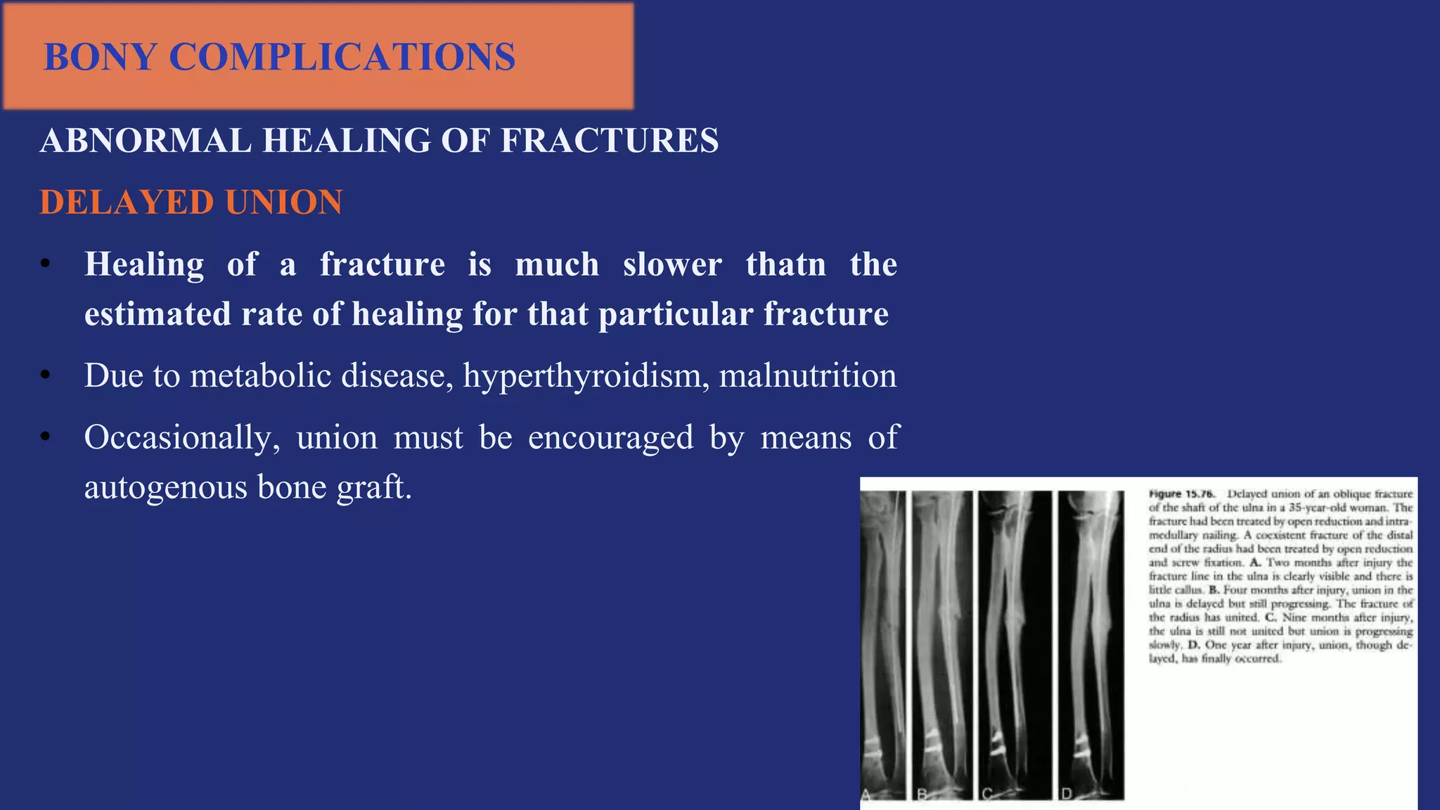BONY COMPLICATIONS
ABNORMAL HEALING OF FRACTURES
DELAYED UNION
• Healing of a fracture is much slower thatn the
estimated rate of healing for that particular fracture
• Due to metabolic disease, hyperthyroidism, malnutrition
• Occasionally, union must be encouraged by means of
autogenous bone graft.
 