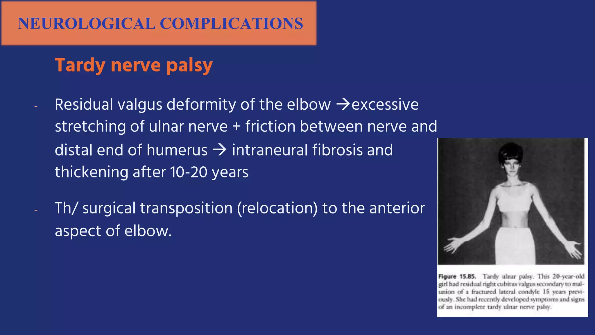 NEUROLOGICAL COMPLICATIONS
Tardy nerve palsy
- Residual valgus deformity of the elbow excessive
stretching of ulnar nerve + friction between nerve and
distal end of humerus  intraneural fibrosis and
thickening after 10-20 years
- Th/ surgical transposition (relocation) to the anterior
aspect of elbow.
 