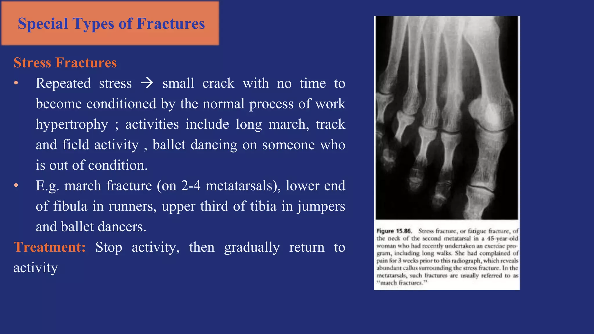 Stress Fractures
• Repeated stress  small crack with no time to
become conditioned by the normal process of work
hypertrophy ; activities include long march, track
and field activity , ballet dancing on someone who
is out of condition.
• E.g. march fracture (on 2-4 metatarsals), lower end
of fibula in runners, upper third of tibia in jumpers
and ballet dancers.
Treatment: Stop activity, then gradually return to
activity
Special Types of Fractures
 