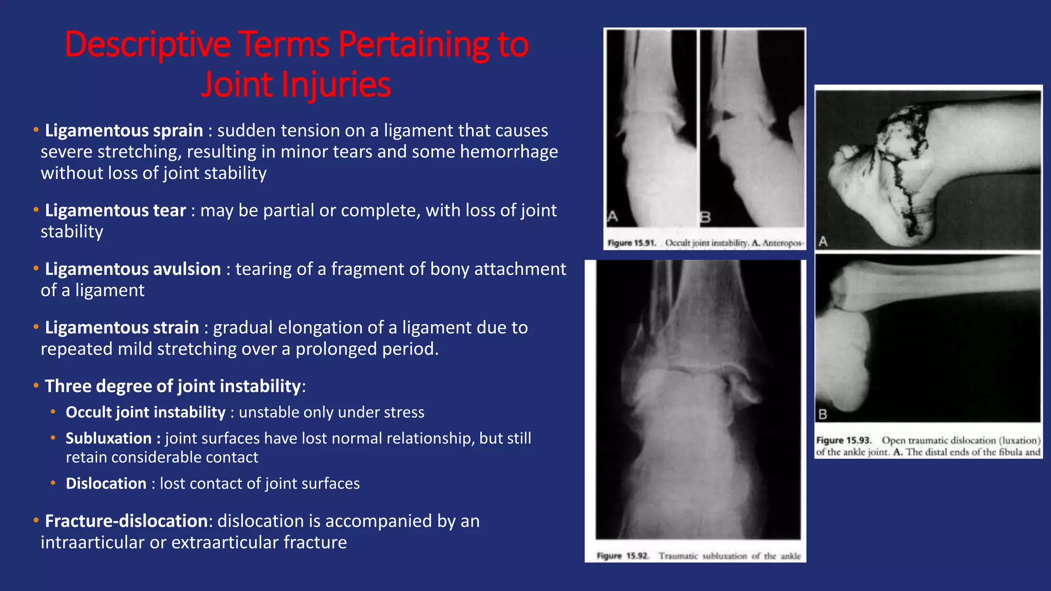 • Ligamentous sprain : sudden tension on a ligament that causes
severe stretching, resulting in minor tears and some hemorrhage
without loss of joint stability
• Ligamentous tear : may be partial or complete, with loss of joint
stability
• Ligamentous avulsion : tearing of a fragment of bony attachment
of a ligament
• Ligamentous strain : gradual elongation of a ligament due to
repeated mild stretching over a prolonged period.
• Three degree of joint instability:
• Occult joint instability : unstable only under stress
• Subluxation : joint surfaces have lost normal relationship, but still
retain considerable contact
• Dislocation : lost contact of joint surfaces
• Fracture-dislocation: dislocation is accompanied by an
intraarticular or extraarticular fracture
Descriptive Terms Pertaining to
Joint Injuries
 
