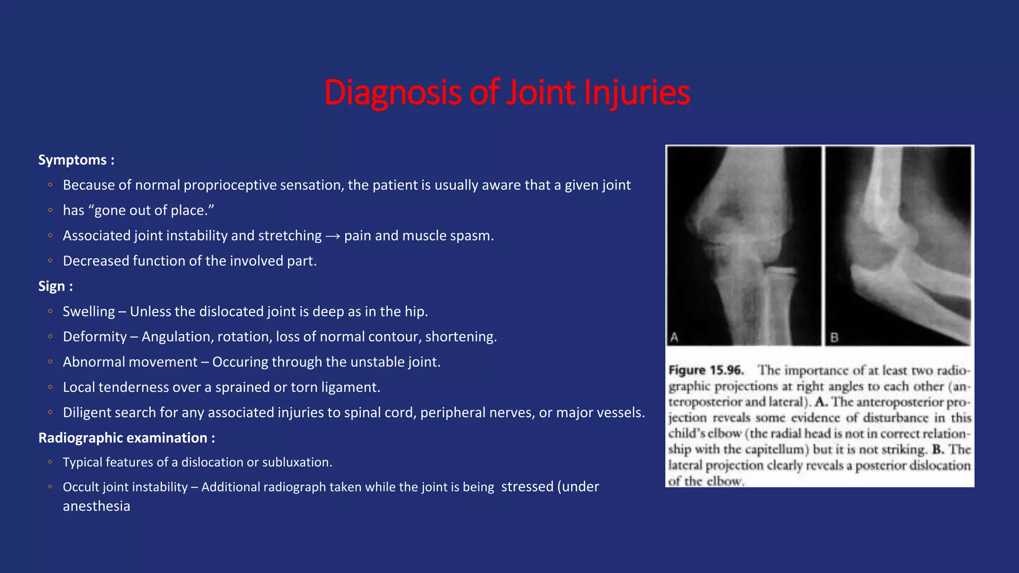 Diagnosis of Joint Injuries
Symptoms :
◦ Because of normal proprioceptive sensation, the patient is usually aware that a given joint
◦ has “gone out of place.”
◦ Associated joint instability and stretching → pain and muscle spasm.
◦ Decreased function of the involved part.
Sign :
◦ Swelling – Unless the dislocated joint is deep as in the hip.
◦ Deformity – Angulation, rotation, loss of normal contour, shortening.
◦ Abnormal movement – Occuring through the unstable joint.
◦ Local tenderness over a sprained or torn ligament.
◦ Diligent search for any associated injuries to spinal cord, peripheral nerves, or major vessels.
Radiographic examination :
◦ Typical features of a dislocation or subluxation.
◦ Occult joint instability – Additional radiograph taken while the joint is being stressed (under
anesthesia
 