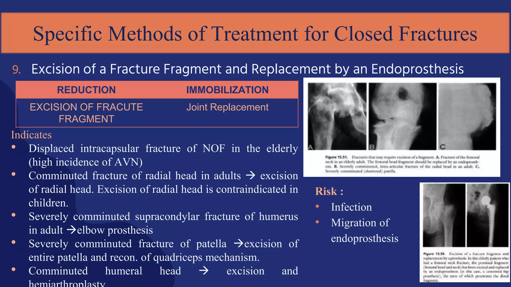 Indicates
• Displaced intracapsular fracture of NOF in the elderly
(high incidence of AVN)
• Comminuted fracture of radial head in adults  excision
of radial head. Excision of radial head is contraindicated in
children.
• Severely comminuted supracondylar fracture of humerus
in adult elbow prosthesis
• Severely comminuted fracture of patella excision of
entire patella and recon. of quadriceps mechanism.
• Comminuted humeral head  excision and
9. Excision of a Fracture Fragment and Replacement by an Endoprosthesis
Specific Methods of Treatment for Closed Fractures
REDUCTION IMMOBILIZATION
EXCISION OF FRACUTE
FRAGMENT
Joint Replacement
Risk :
• Infection
• Migration of
endoprosthesis
 