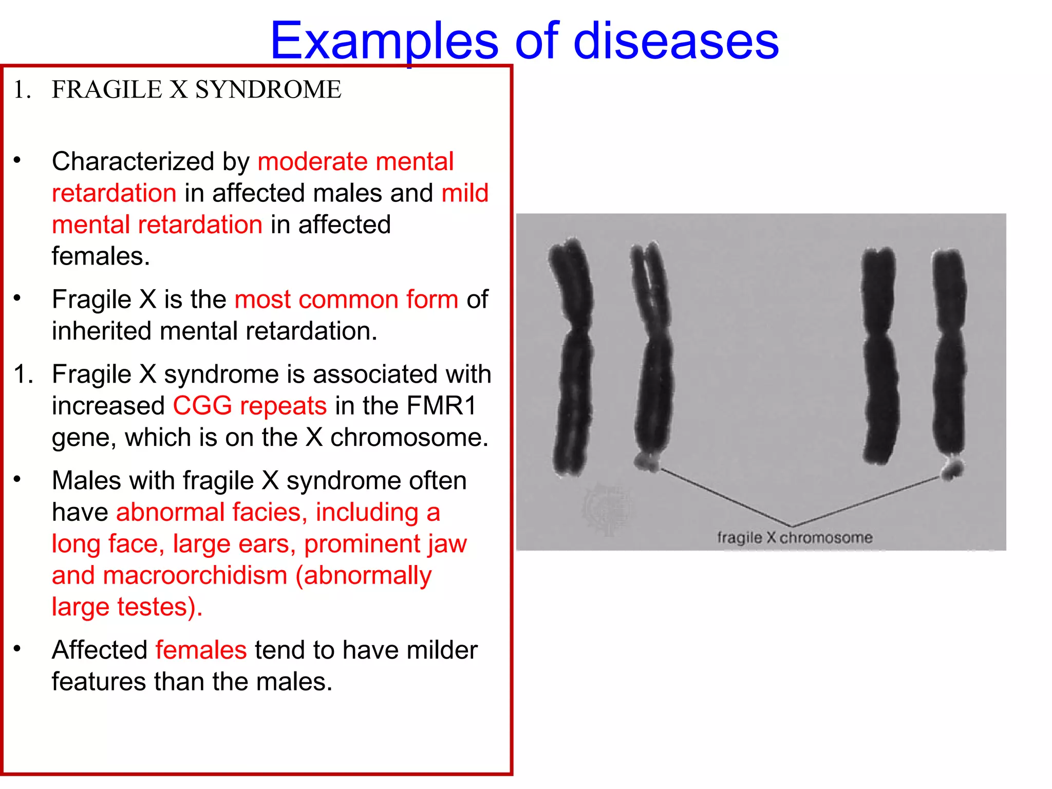 Examples of diseases
1. FRAGILE X SYNDROME
• Characterized by moderate mental
retardation in affected males and mild
mental retardation in affected
females.
• Fragile X is the most common form of
inherited mental retardation.
1. Fragile X syndrome is associated with
increased CGG repeats in the FMR1
gene, which is on the X chromosome.
• Males with fragile X syndrome often
have abnormal facies, including a
long face, large ears, prominent jaw
and macroorchidism (abnormally
large testes).
• Affected females tend to have milder
features than the males.
 