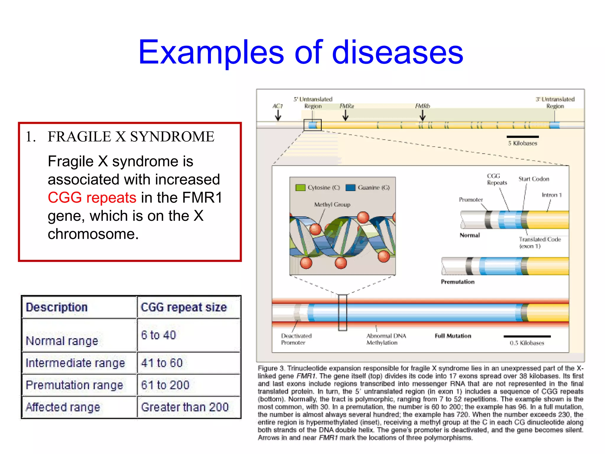 Examples of diseases
1. FRAGILE X SYNDROME
Fragile X syndrome is
associated with increased
CGG repeats in the FMR1
gene, which is on the X
chromosome.
 