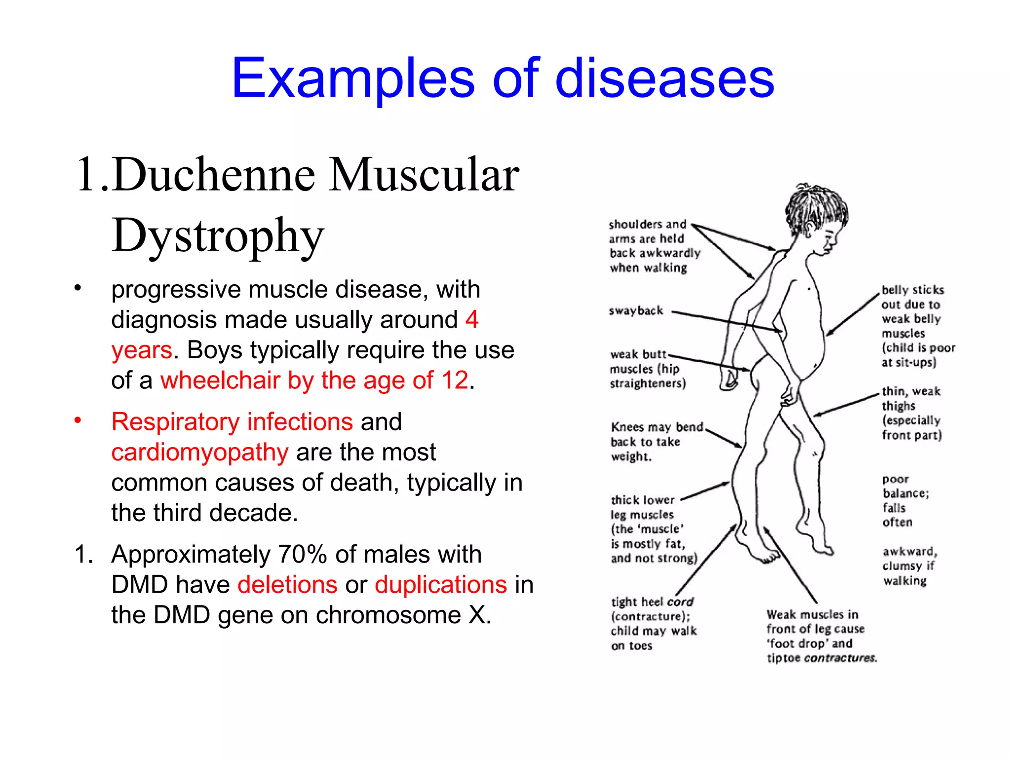Examples of diseases
1.Duchenne Muscular
Dystrophy
• progressive muscle disease, with
diagnosis made usually around 4
years. Boys typically require the use
of a wheelchair by the age of 12.
• Respiratory infections and
cardiomyopathy are the most
common causes of death, typically in
the third decade.
1. Approximately 70% of males with
DMD have deletions or duplications in
the DMD gene on chromosome X.
 