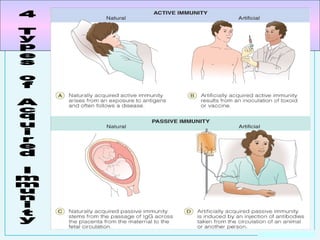 4 Types of Acquired Immunity 