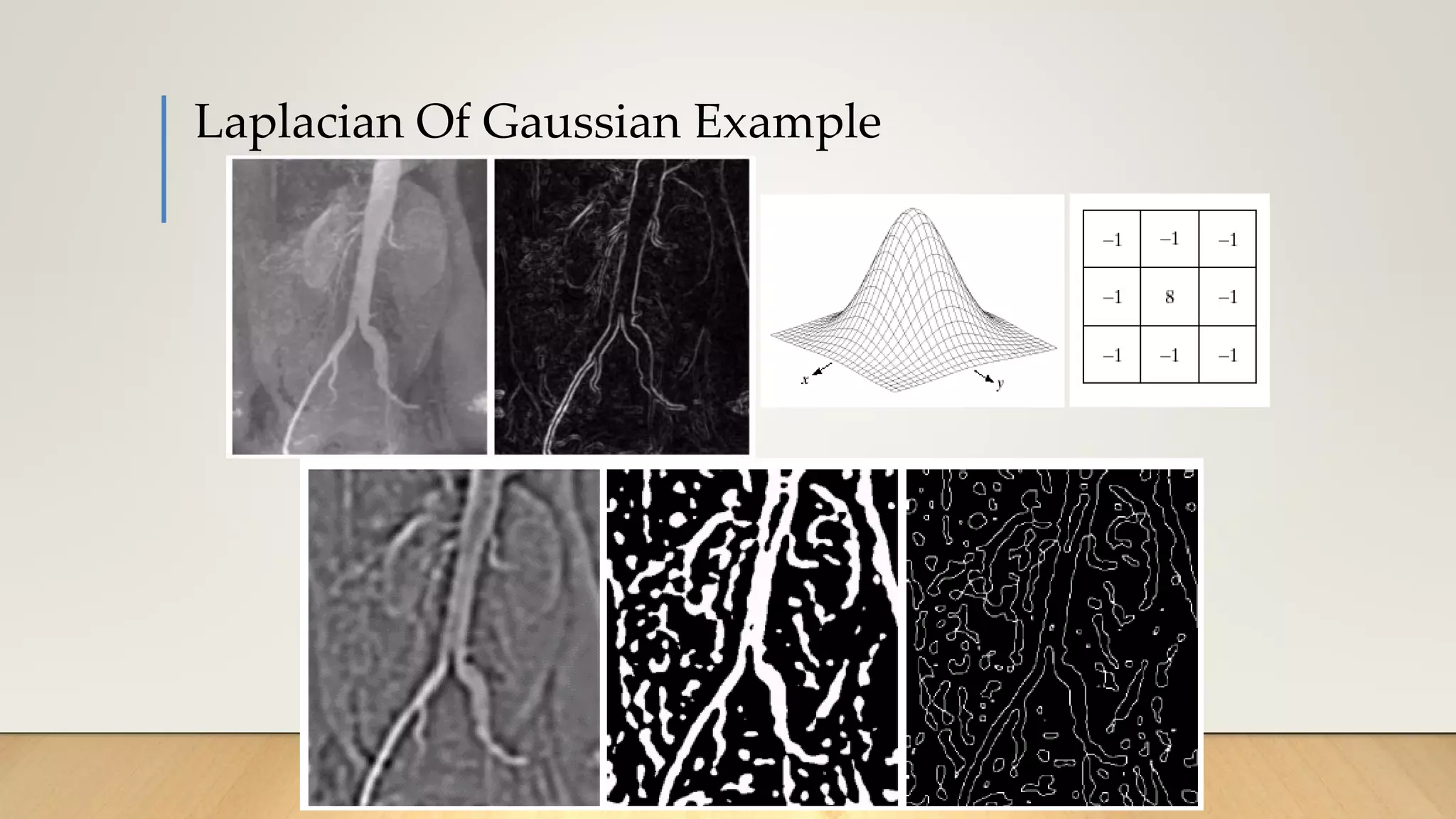 Laplacian Of Gaussian Example
 