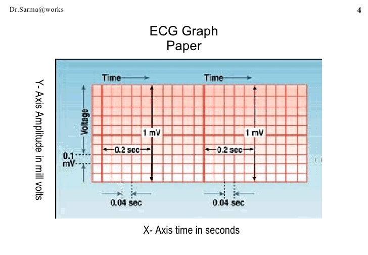 electrocardiogram ecg graph paper scale