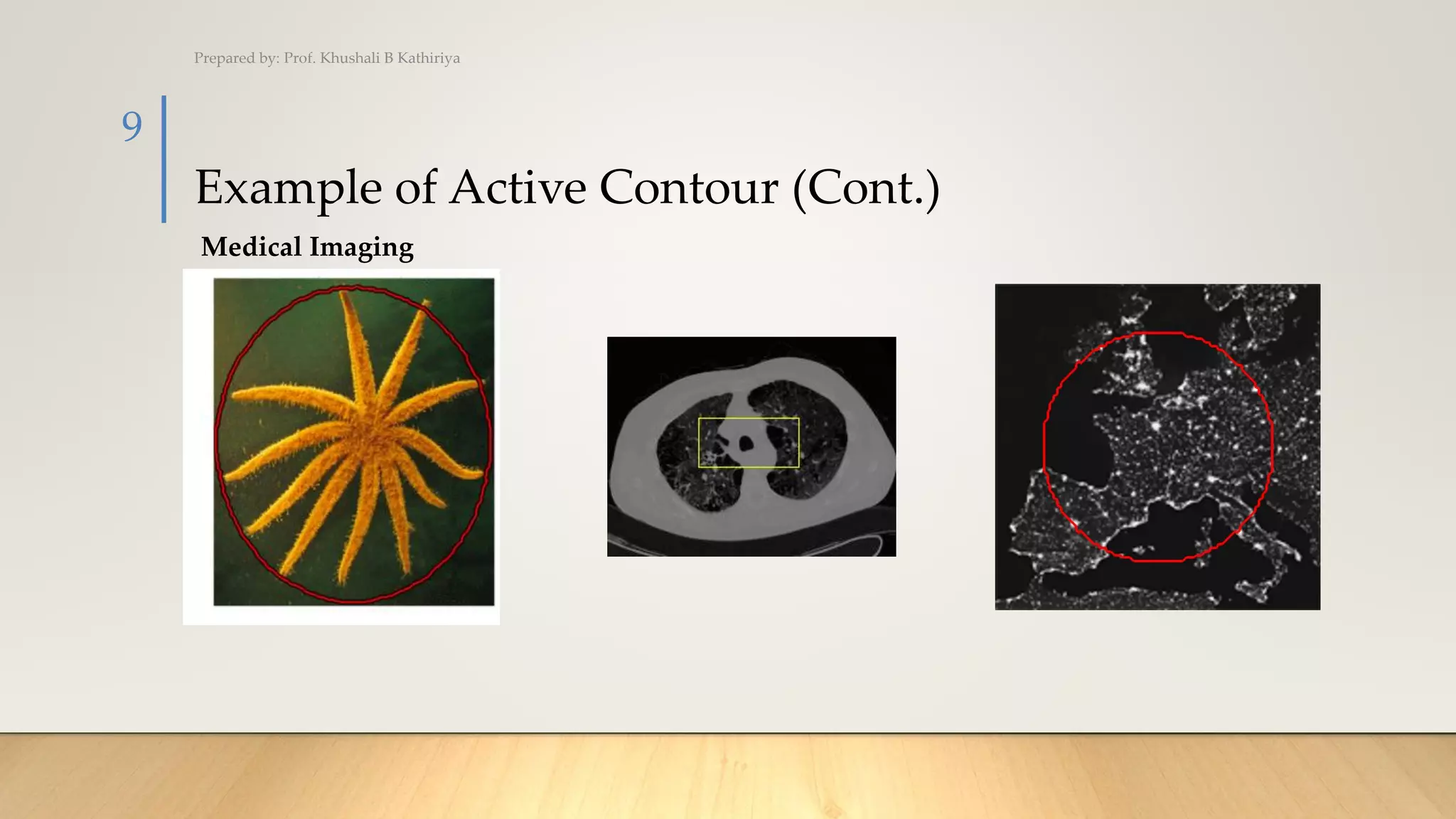 Example of Active Contour (Cont.)
Prepared by: Prof. Khushali B Kathiriya
9
Medical Imaging
 