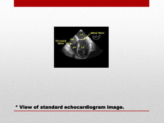 * View of standard echocardiogram image.