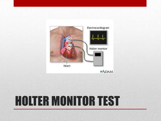 HOLTER MONITOR TEST