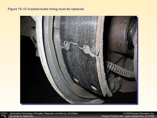 Figure 75–12 Cracked brake lining must be replaced. 