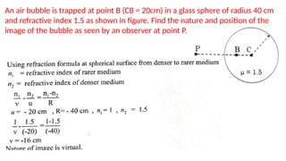 An air bubble is trapped at point B (CB = 20cm) in a glass sphere of radius 40 cm
and refractive index 1.5 as shown in figure. Find the nature and position of the
image of the bubble as seen by an observer at point P.
 