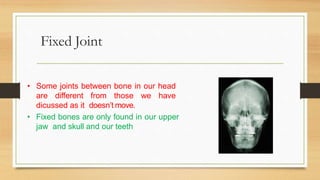 Fixed Joint
• Some joints between bone in our head
are different from those we have
dicussed as it doesn’t move.
• Fixed bones are only found in our upper
jaw and skull and our teeth
 