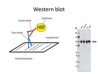 Western blot
 