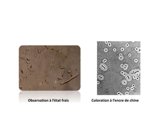 Coloration à l’encre de chineObservation à l’état frais
 