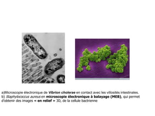 a)Microscopie électronique de Vibrion cholerae en contact avec les villosités intestinales.
b) Staphylococcus aureus en microscopie électronique à balayage (MEB), qui permet
d’obtenir des images « en relief » 3D, de la cellule bactrienne
 