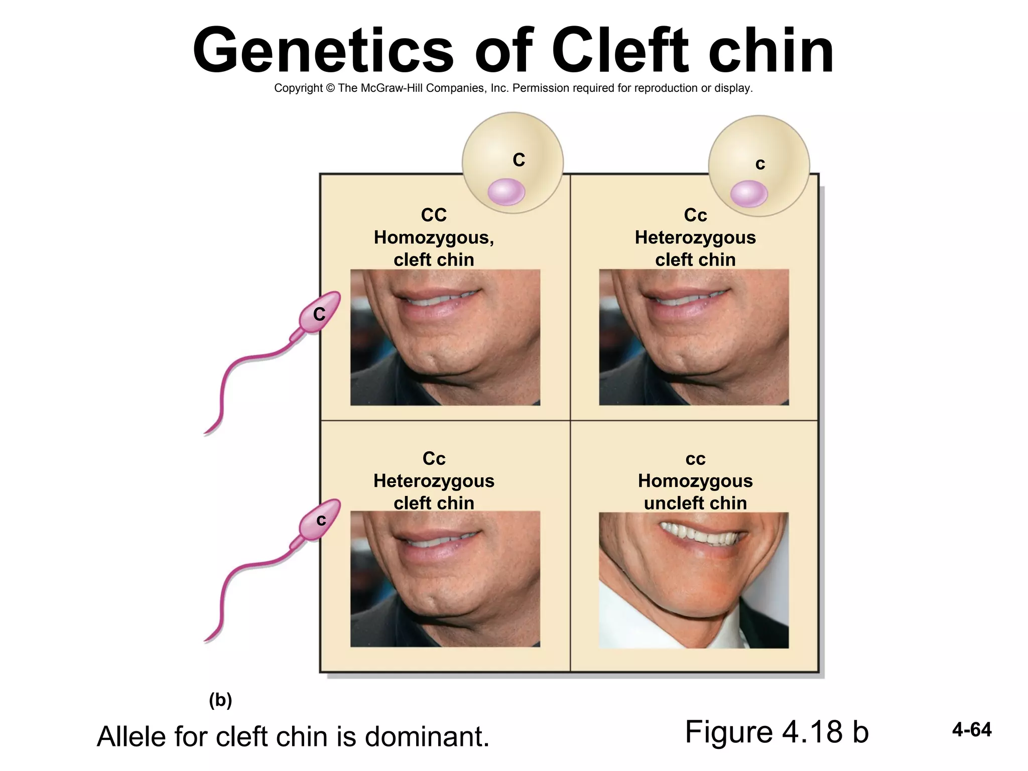 4-64
Genetics of Cleft chin
Figure 4.18 bAllele for cleft chin is dominant.
(b)
C c
c
C
Cc
Heterozygous
cleft chin
Cc
Heterozygous
cleft chin
cc
Homozygous
uncleft chin
CC
Homozygous,
cleft chin
Copyright © The McGraw-Hill Companies, Inc. Permission required for reproduction or display.
 