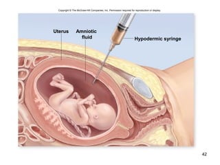 42
Uterus Amniotic
fluid Hypodermic syringe
Copyright © The McGraw-Hill Companies, Inc. Permission required for reproduction or display.
 