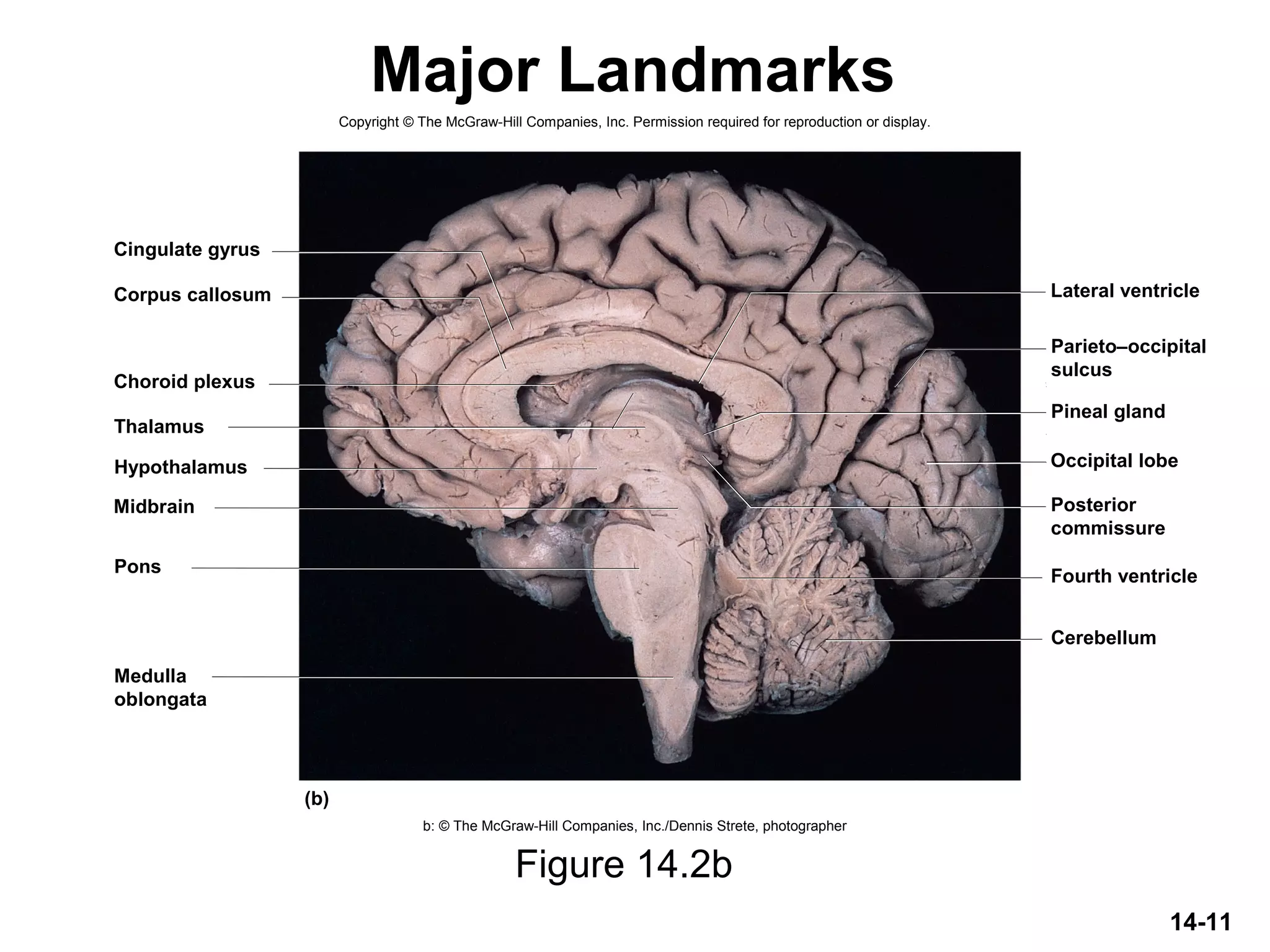 14-11
Major Landmarks
Figure 14.2b
Copyright © The McGraw-Hill Companies, Inc. Permission required for reproduction or display.
b: © The McGraw-Hill Companies, Inc./Dennis Strete, photographer
Corpus callosum
Cingulate gyrus
Lateral ventricle
Thalamus
Hypothalamus
Midbrain
Cerebellum
Fourth ventriclePons
(b)
Choroid plexus
Pineal gland
Occipital lobe
Medulla
oblongata
Parieto–occipital
sulcus
Posterior
commissure
 