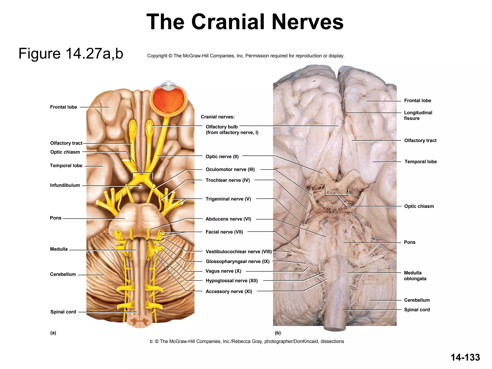 14-133
The Cranial Nerves
Figure 14.27a,b Copyright © The McGraw-Hill Companies, Inc. Permission required for reproduction or display.
b: © The McGraw-Hill Companies, Inc./Rebecca Gray, photographer/DonKincaid, dissections
Cranial nerves:
Optic nerve (II)
Trochlear nerve (IV)
Trigeminal nerve (V)
Abducens nerve (VI)
Facial nerve (VII)
Vestibulocochlear nerve (VIII)
Glossopharyngeal nerve (IX)
Accessory nerve (XI)
Hypoglossal nerve (XII)
Oculomotor nerve (III)
Frontal lobe
Frontal lobe
Cerebellum
Cerebellum
Olfactory tract
Temporal lobe
Infundibulum
Pons
Medulla
Optic chiasm
Optic chiasm
Olfactory tract
Pons
Spinal cordSpinal cord
(a) (b)
Longitudinal
fissure
Medulla
oblongata
Olfactory bulb
(from olfactory nerve, I)
Vagus nerve (X)
Temporal lobe
 