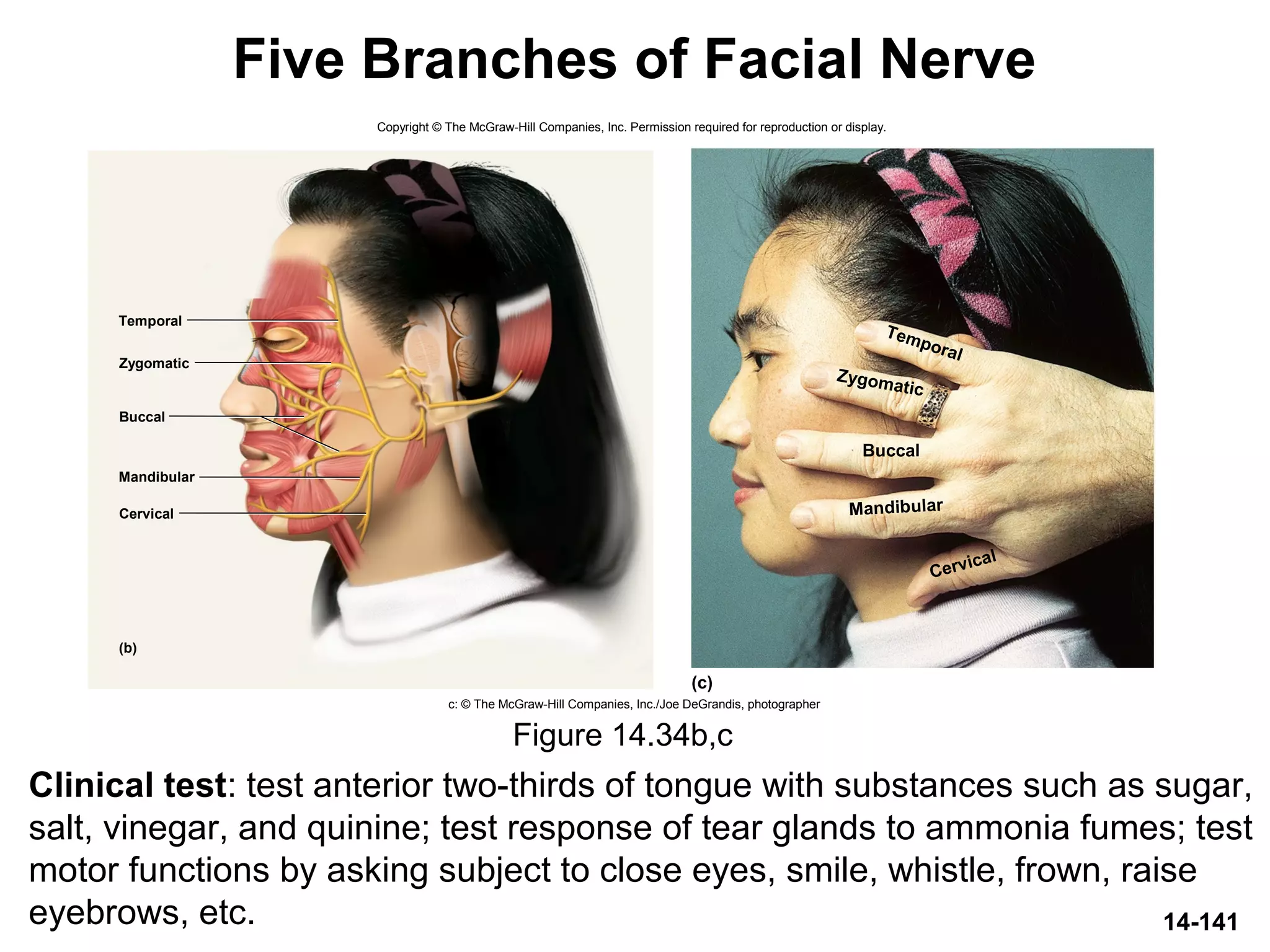 14-141
Five Branches of Facial Nerve
Clinical test: test anterior two-thirds of tongue with substances such as sugar,
salt, vinegar, and quinine; test response of tear glands to ammonia fumes; test
motor functions by asking subject to close eyes, smile, whistle, frown, raise
eyebrows, etc.
Figure 14.34b,c
Copyright © The McGraw-Hill Companies, Inc. Permission required for reproduction or display.
Temporal
Zygomatic
Buccal
Mandibular
Cervical
(c)
c: © The McGraw-Hill Companies, Inc./Joe DeGrandis, photographer
Zygomatic
Buccal
Mandibular
Cervical
(b)
Temporal
 