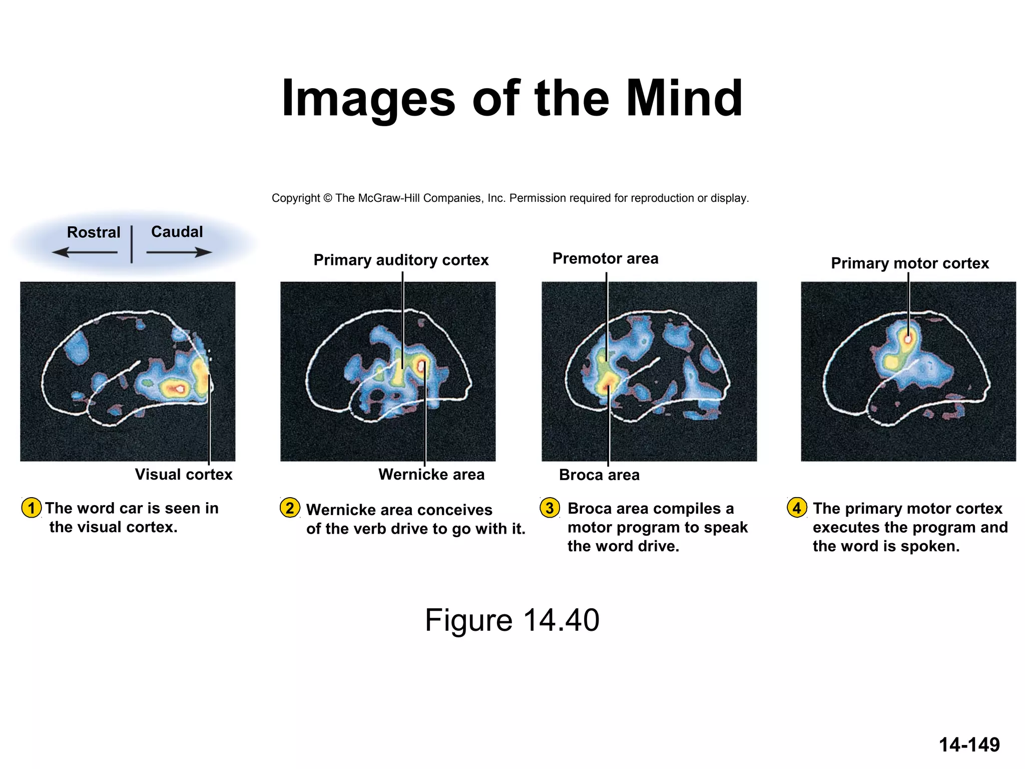 14-149
Images of the Mind
Figure 14.40
Copyright © The McGraw-Hill Companies, Inc. Permission required for reproduction or display.
Broca area
Primary motor cortexPremotor areaPrimary auditory cortex
1 2 3 4
Rostral Caudal
Wernicke area conceives
of the verb drive to go with it.
Broca area compiles a
motor program to speak
the word drive.
The primary motor cortex
executes the program and
the word is spoken.
Wernicke areaVisual cortex
The word car is seen in
the visual cortex.
 