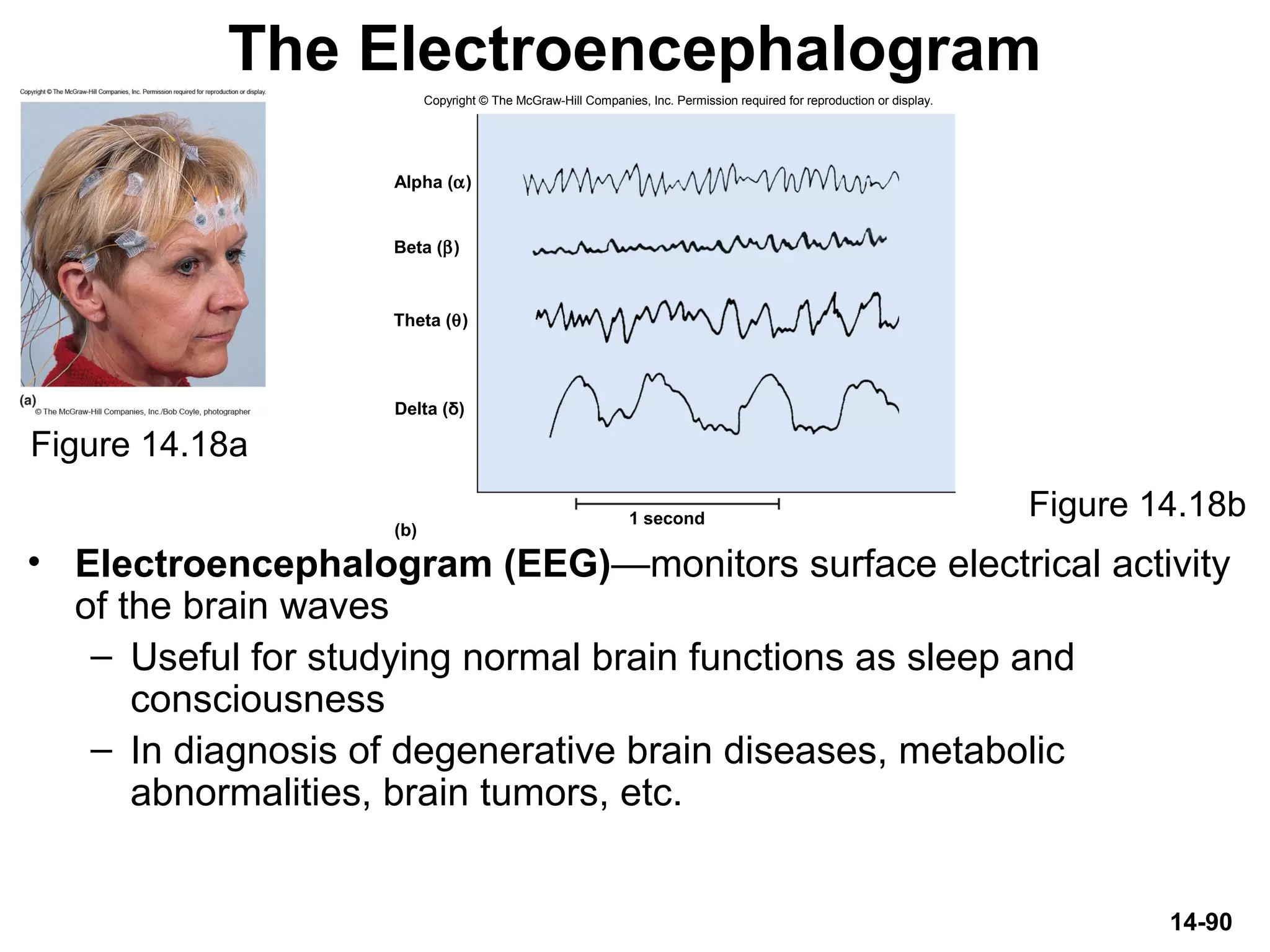 14-90
The Electroencephalogram
• Electroencephalogram (EEG)—monitors surface electrical activity
of the brain waves
– Useful for studying normal brain functions as sleep and
consciousness
– In diagnosis of degenerative brain diseases, metabolic
abnormalities, brain tumors, etc.
Figure 14.18a
Figure 14.18b
Delta (δ)
(b)
1 second
Alpha (α)
Theta (θ)
Beta (β)
Copyright © The McGraw-Hill Companies, Inc. Permission required for reproduction or display.
 
