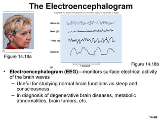 14-90
The Electroencephalogram
• Electroencephalogram (EEG)—monitors surface electrical activity
of the brain waves
– Useful for studying normal brain functions as sleep and
consciousness
– In diagnosis of degenerative brain diseases, metabolic
abnormalities, brain tumors, etc.
Figure 14.18a
Figure 14.18b
Delta (δ)
(b)
1 second
Alpha (α)
Theta (θ)
Beta (β)
Copyright © The McGraw-Hill Companies, Inc. Permission required for reproduction or display.
 