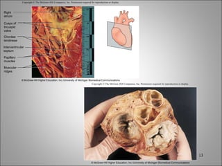 Copyright © The McGraw-Hill Companies, Inc. Permission required for reproduction or display. Right atrium Cusps of tricuspid valve Chordae tendineae Interventricular septum Papillary muscles Muscular ridges © McGraw-Hill Higher Education, Inc./University of Michigan Biomedical Communications Copyright © The McGraw-Hill Companies, Inc. Permission required for reproduction or display. © McGraw-Hill Higher Education, Inc./University of Michigan Biomedical Communications 