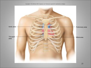 Copyright © The McGraw-Hill Companies, Inc. Permission required for reproduction or display. Aortic area Pulmonary area Mitral area Tricuspid area 