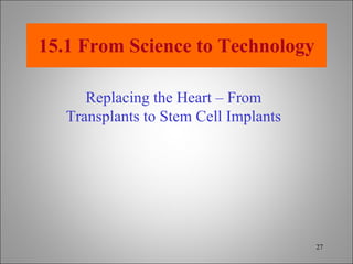 15.1 From Science to Technology Replacing the Heart – From Transplants to Stem Cell Implants 
