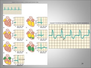 Copyright © The McGraw-Hill Companies, Inc. Permission required for reproduction or display. (b) (c) (d) (e) (f) Millivolts 0 – .5 .5 1.0 Milliseconds 0 200 400 600 Millivolts 0 – .5 .5 1.0 Milliseconds 0 200 400 600 Millivolts 0 – .5 .5 1.0 Milliseconds 0 200 400 600 P Millivolts 0 – .5 .5 1.0 Milliseconds 0 200 400 600 S Q R QRS complex (h) (g) Millivolts 0 – .5 .5 1.0 Milliseconds 0 200 400 600 Millivolts 0 – .5 .5 1.0 Milliseconds 0 200 400 600 T Millivolts 0 – .5 .5 1.0 Milliseconds 0 200 400 600 (a) Copyright © The McGraw-Hill Companies, Inc. Permission required for reproduction or display. S Q R 