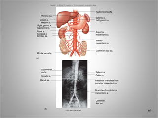Copyright © The McGraw-Hill Companies, Inc. Permission required for reproduction or display. Hepatic a. Renal aa. Splenic a. Celiac a. (b) (a) Right gastric a. Hepatic a. Celiac a. Phrenic aa. Suprarenal a. Renal a. Middle sacral a. Gonadal a. Lumbar aa. Abdominal aorta Splenic a. Left gastric a. Common iliac aa. Superior mesenteric a. Inferior mesenteric a. Intestinal branches from superior mesenteric a. Branches from inferior mesenteric a. Common iliac aa. Abdominal aorta b: © Dr. Kent M. Van De Graaff 