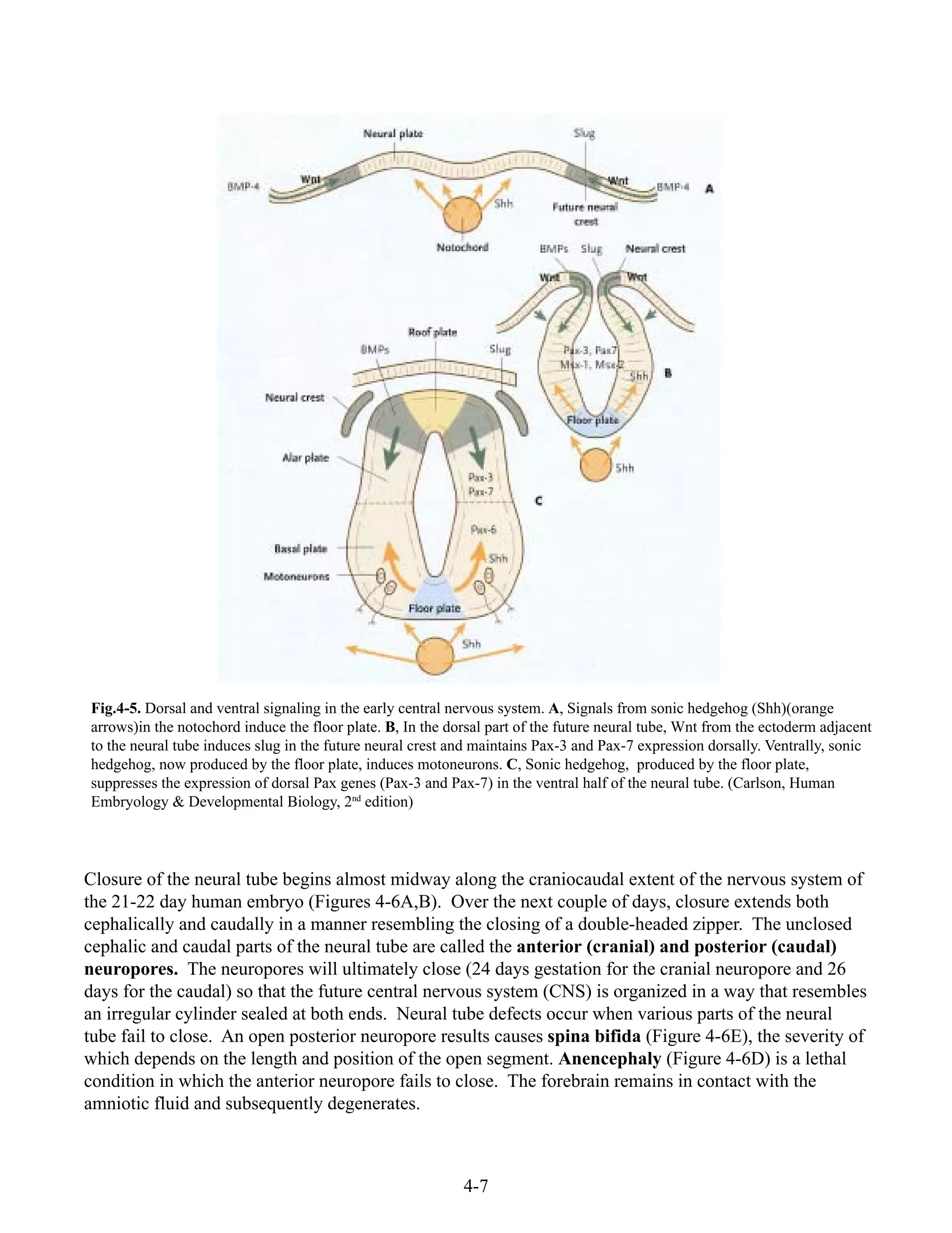 4-7
Closure of the neural tube begins almost midway along the craniocaudal extent of the nervous system of
the 21-22 day human embryo (Figures 4-6A,B). Over the next couple of days, closure extends both
cephalically and caudally in a manner resembling the closing of a double-headed zipper. The unclosed
cephalic and caudal parts of the neural tube are called the anterior (cranial) and posterior (caudal)
neuropores. The neuropores will ultimately close (24 days gestation for the cranial neuropore and 26
days for the caudal) so that the future central nervous system (CNS) is organized in a way that resembles
an irregular cylinder sealed at both ends. Neural tube defects occur when various parts of the neural
tube fail to close. An open posterior neuropore results causes spina bifida (Figure 4-6E), the severity of
which depends on the length and position of the open segment. Anencephaly (Figure 4-6D) is a lethal
condition in which the anterior neuropore fails to close. The forebrain remains in contact with the
amniotic fluid and subsequently degenerates.
Fig.4-5. Dorsal and ventral signaling in the early central nervous system. A, Signals from sonic hedgehog (Shh)(orange
arrows)in the notochord induce the floor plate. B, In the dorsal part of the future neural tube, Wnt from the ectoderm adjacent
to the neural tube induces slug in the future neural crest and maintains Pax-3 and Pax-7 expression dorsally. Ventrally, sonic
hedgehog, now produced by the floor plate, induces motoneurons. C, Sonic hedgehog, produced by the floor plate,
suppresses the expression of dorsal Pax genes (Pax-3 and Pax-7) in the ventral half of the neural tube. (Carlson, Human
Embryology & Developmental Biology, 2nd
edition)
 