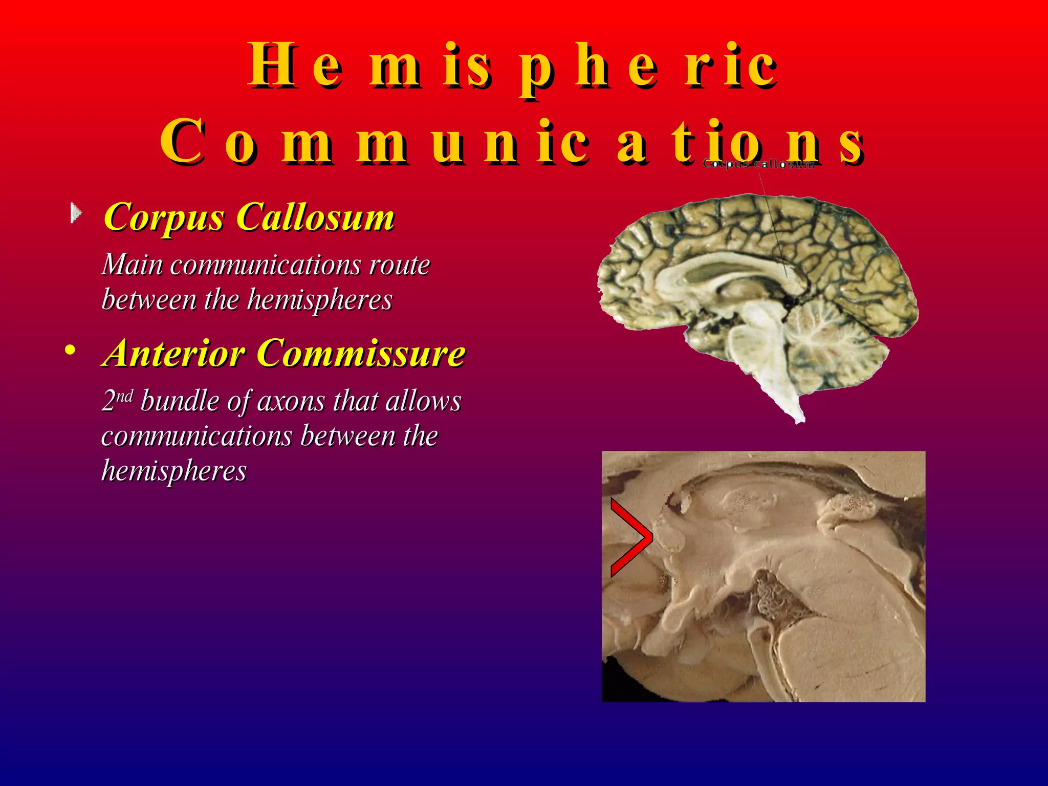 Hemispheric Communications Corpus Callosum Main communications route between the hemispheres Anterior Commissure 2 nd  bundle of axons that allows communications between the hemispheres > 