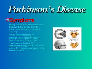 Parkinson’s Disease Symptoms Rigidity, resting tremor, slow movements & difficulty initiating physical & mental activity, cognitive defects in memory & reasoning 1 in 100 with onset after age 50 Immediate cause: gradual progressive death of neurons in Substantia Nigra Possible causes: Genetics; MPTP, a chemical that the body converts into MPP (a toxin destroys dopamine neurons; probably a mixture of causes 