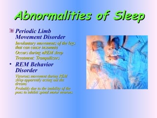 Abnormalities of Sleep Periodic Limb Movement Disorder Involuntary movements of the legs that can cause insomnia Occurs during nREM sleep Treatment: Tranquilizers REM Behavior Disorder Vigorous movement during REM sleep apparently acting out the dreams Probably due to the inability of the pons to inhibit spinal motor neurons 