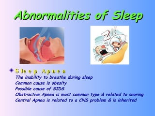 Abnormalities of Sleep Sleep Apnea The inability to breathe during sleep Common cause is obesity Possible cause of SIDS Obstructive Apnea is most common type & related to snoring Central Apnea is related to a CNS problem & is inherited 