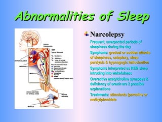 Abnormalities of Sleep Narcolepsy Frequent, unexpected periods of sleepiness during the day Symptoms:  gradual or sudden attacks of sleepiness, cataplexy, sleep paralysis & hypnogogic hallucination Symptoms interpreted as REM sleep intruding into wakefulness Overactive acetylcholine synapses & deficiency of  orexin  are 2 possible explanations Treatments:  stimulants (pemoline or methylphenidate 