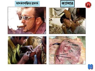 মােক্াসব্রক্তর প্রভাব ক্যান্সার
 