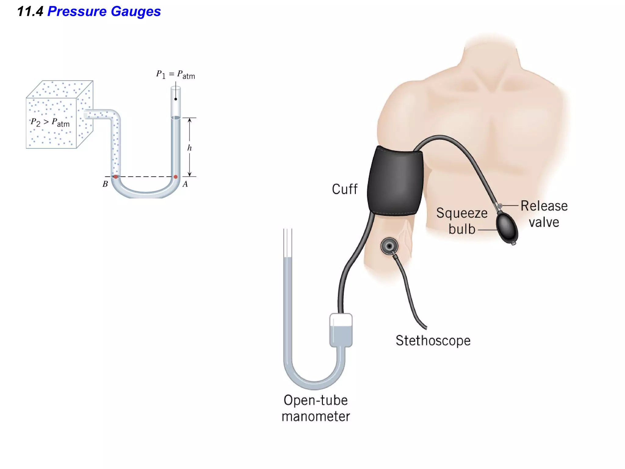 11.4  Pressure Gauges 