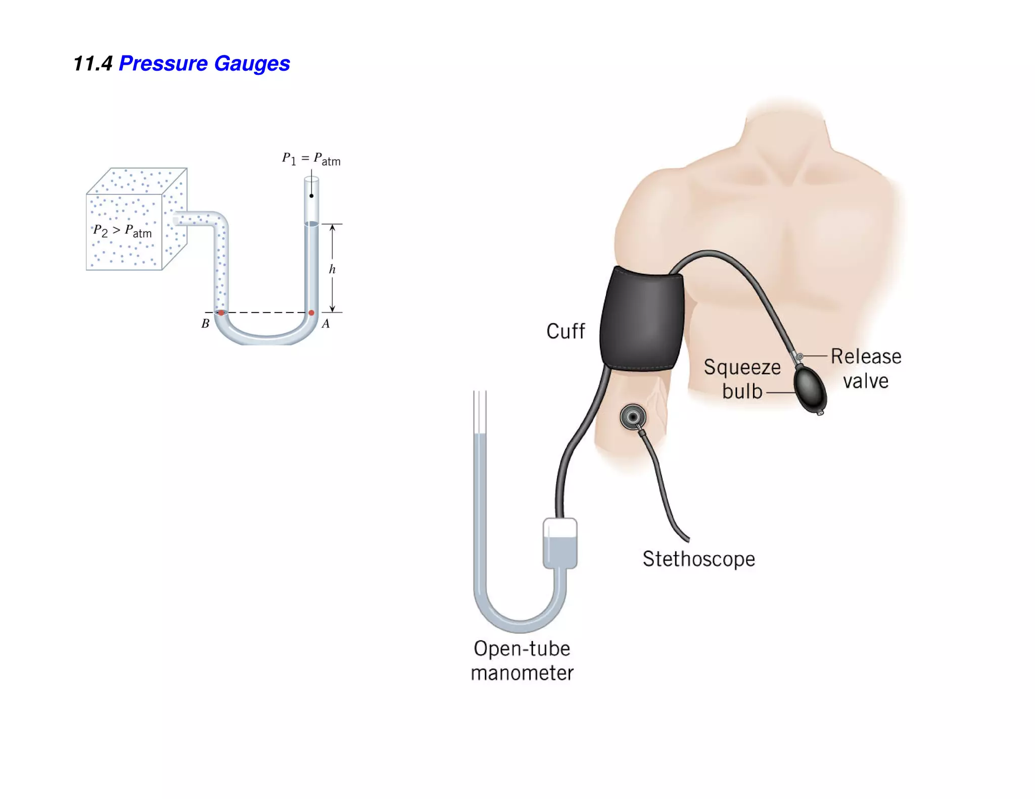 11.4 Pressure Gauges
 