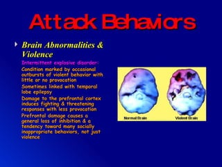 Attack Behaviors Brain Abnormalities & Violence Intermittent explosive disorder: Condition marked by occasional outbursts of violent behavior with little or no provocation Sometimes linked with temporal lobe epilepsy Damage to the prefrontal cortex induces fighting & threatening responses with less provocation Prefrontal damage causes a general loss of inhibition & a tendency toward many socially inappropriate behaviors, not just violence 