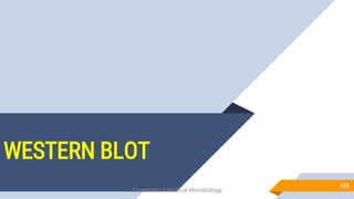 WESTERN BLOT
115
Essentials of Medical Microbiology
 