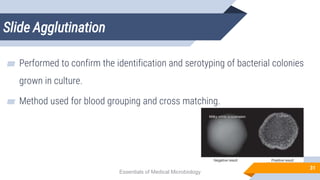 Slide Agglutination
31
▰ Performed to confirm the identification and serotyping of bacterial colonies
grown in culture.
▰ Method used for blood grouping and cross matching.
Essentials of Medical Microbiology
 