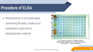 Procedure of ELISA
60
▰ Performed on a microtiter plate
containing 96 wells, made up of
polystyrene, polyvinyl or
polycarbonate material.
Essentials of Medical Microbiology
 
