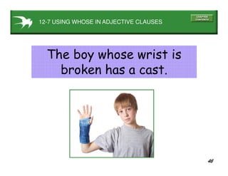 46
12-7 USING WHOSE IN ADJECTIVE CLAUSES
The boy whose wrist is
broken has a cast.
 