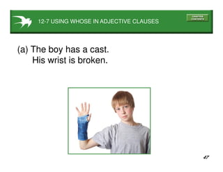 47
12-7 USING WHOSE IN ADJECTIVE CLAUSES
(a) The boy has a cast.
His wrist is broken.
 