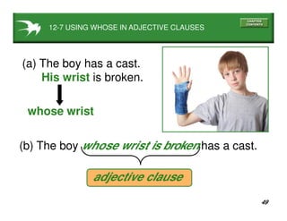 49
12-7 USING WHOSE IN ADJECTIVE CLAUSES
(a) The boy has a cast.
His wrist is broken.
(b) The boy whose wrist is broken has a cast.
adjective clause
whose wrist
 